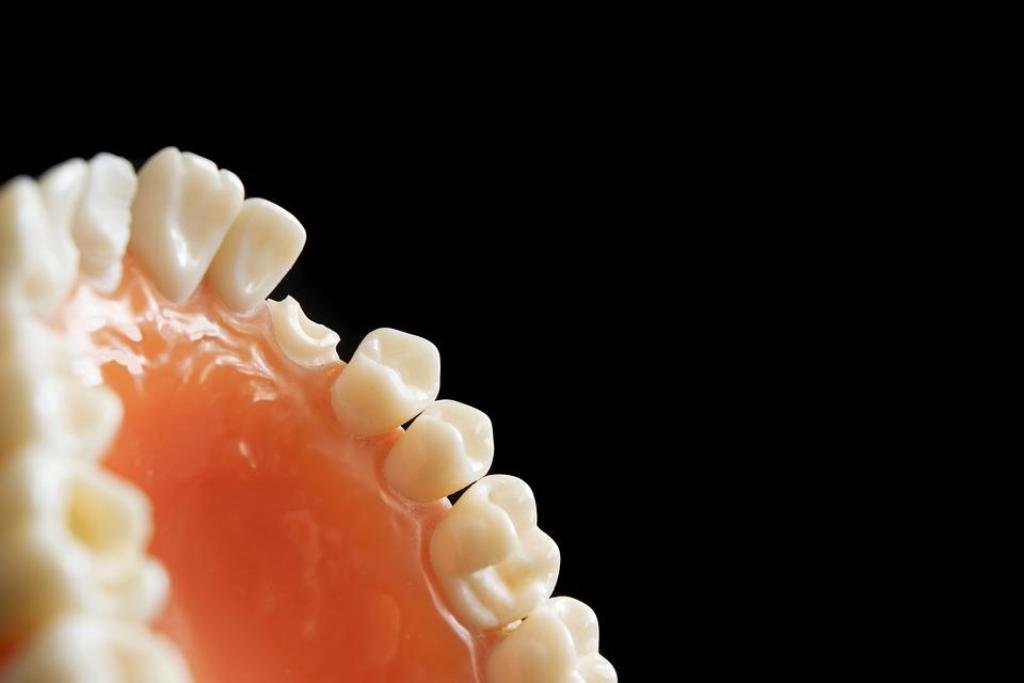 The Importance Of Restorative Dentistry Procedures